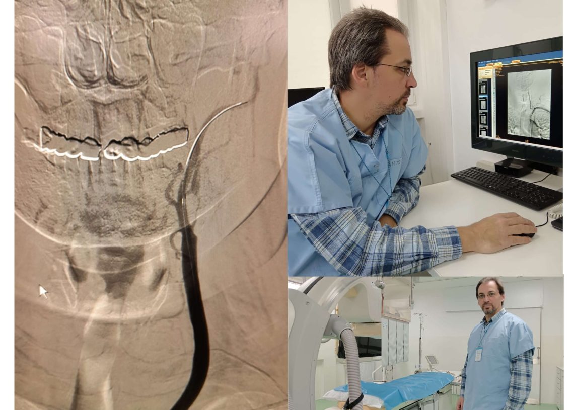 Premieră medicală la SJU Buzău: două intervenții de radiologie intervențională realizate cu succes