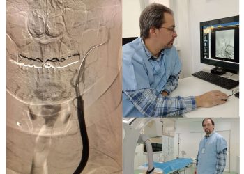 Premieră medicală la SJU Buzău: două intervenții de radiologie intervențională realizate cu succes